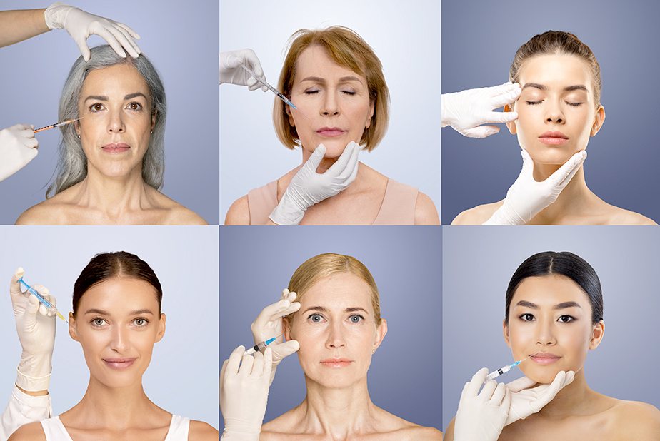 Filler facciali in Italia: un mercato in crescita, con spazi da costruire volti di donne a cui vengono effettuate iniezioni di filler
